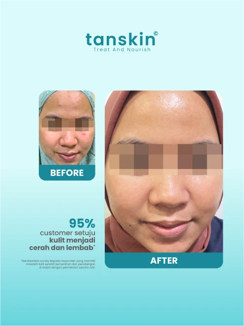 Day Barrier Murah