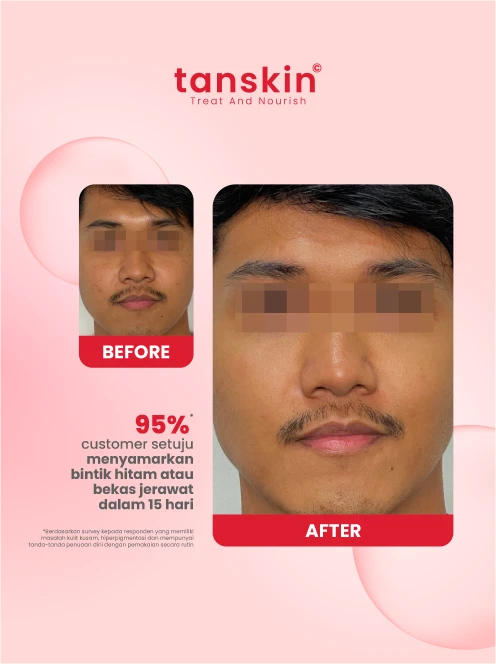 Radiance Serum Tanskin