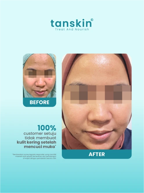 Review Glass Skin Cleansing Gel Terbaik